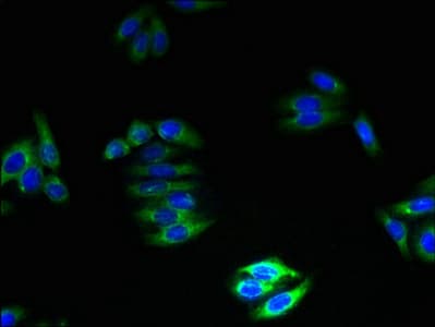 GPM6B Antibody