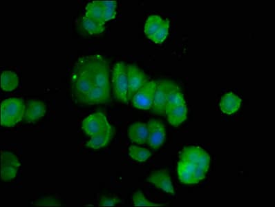 Polyclonal Rabbit anti-Human POLD3 Antibody (IHC, WB)