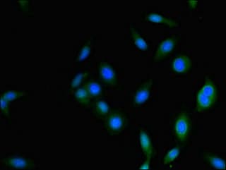 PSMD2 Antibody