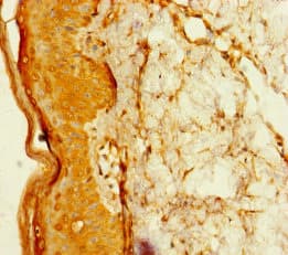 TADA2B Antibody