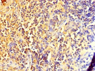 DIS3L2 Antibody