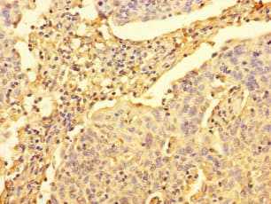 UPRT Antibody