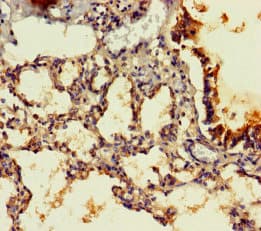 PPP1R16B Antibody