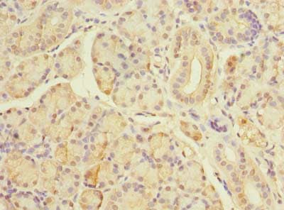 TBC1D19 Antibody
