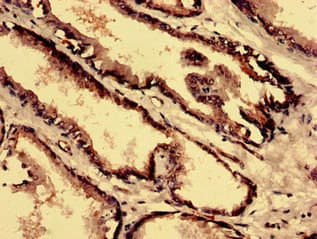 CPNE4 Antibody