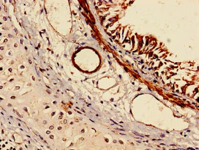 RABGGTA Antibody