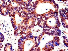 ACSF2 Antibody