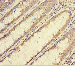 FBXL17 Antibody