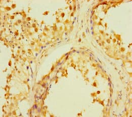 RAB6C Antibody