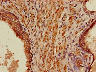 PIH1D3 Antibody
