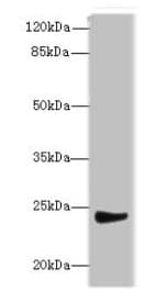MRPL22 Antibody