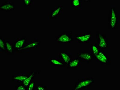 RAD54B Antibody