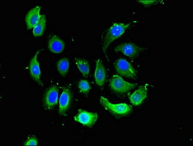 VSIG4 Antibody