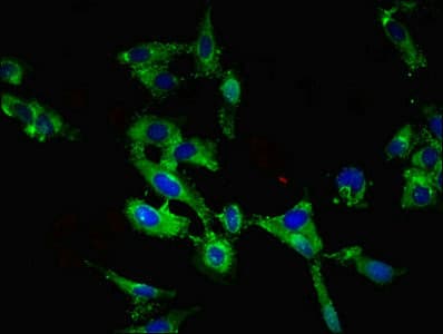 ROBO1 Antibody