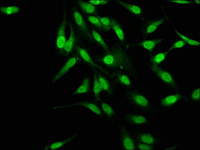 MAGED2 Antibody