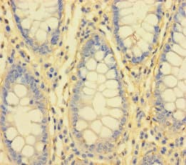 IL1RL2 Antibody