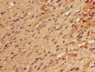 RBM22 Antibody