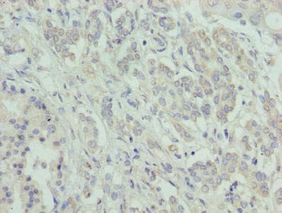 ATXN7L1 Antibody