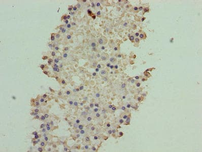 ATXN7L1 Antibody