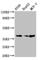 Polyclonal Rabbit anti-Human C/EBP Alpha / CEBPA Antibody (IHC)