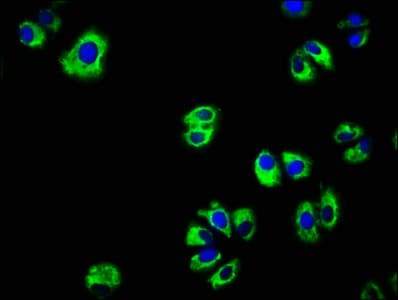 Polyclonal Rabbit anti-Human EGFR Antibody (WB)