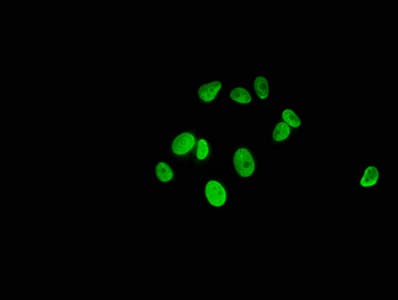 Polyclonal Rabbit anti-Human HIST1H1C Antibody (WB)