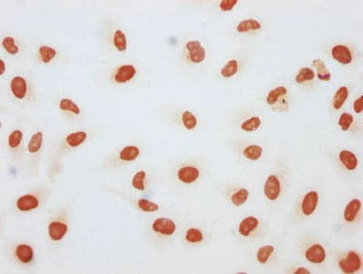 HIST1H3A Antibody