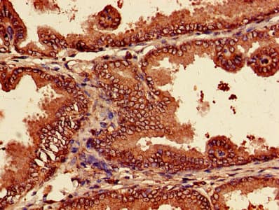 PSMA7 Antibody