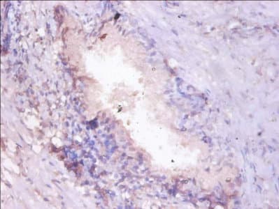 PSMA7 Antibody