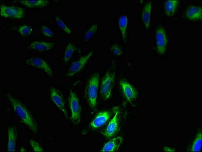SNRPG Antibody