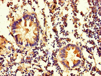 OLA1 Antibody