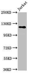 Polyclonal Rabbit anti-Human SREBF1 / SREBP-1 Antibody (IHC)