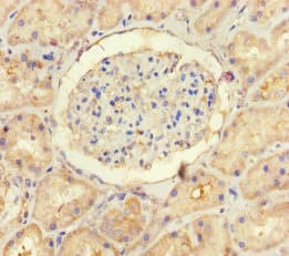 USP14 Antibody