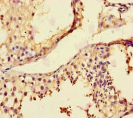 MMP12 Antibody