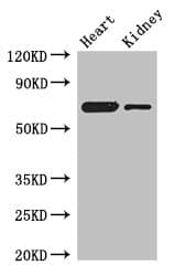 ETFDH Antibody