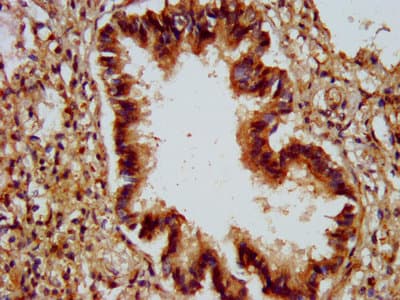 ALG9 Antibody