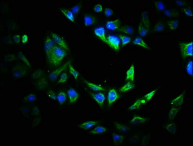 VIPAS39 Antibody