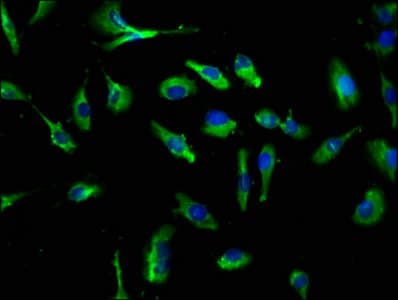 IHC-plus™ Polyclonal Rabbit anti-Human CLEC4E / MINCLE Antibody (IHC, IF)