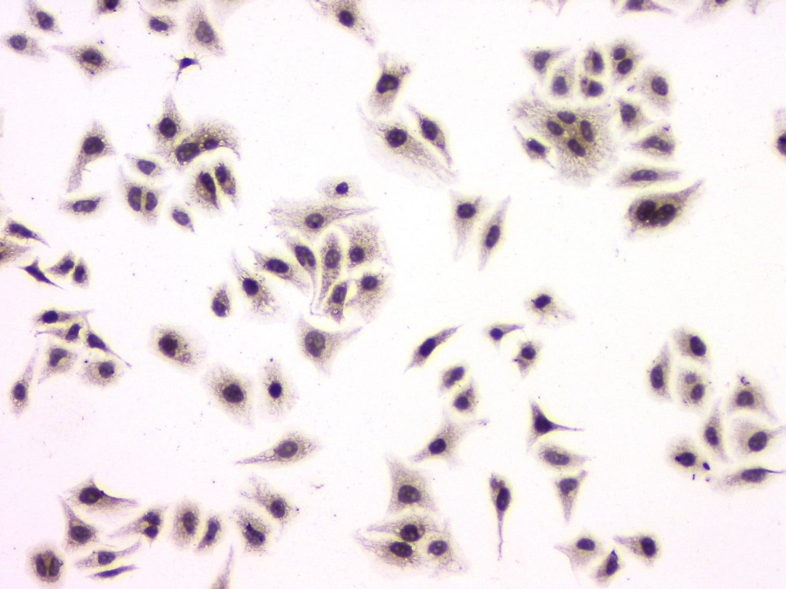 Polyclonal Rabbit anti-Human SP1 Antibody (IHC, WB)
