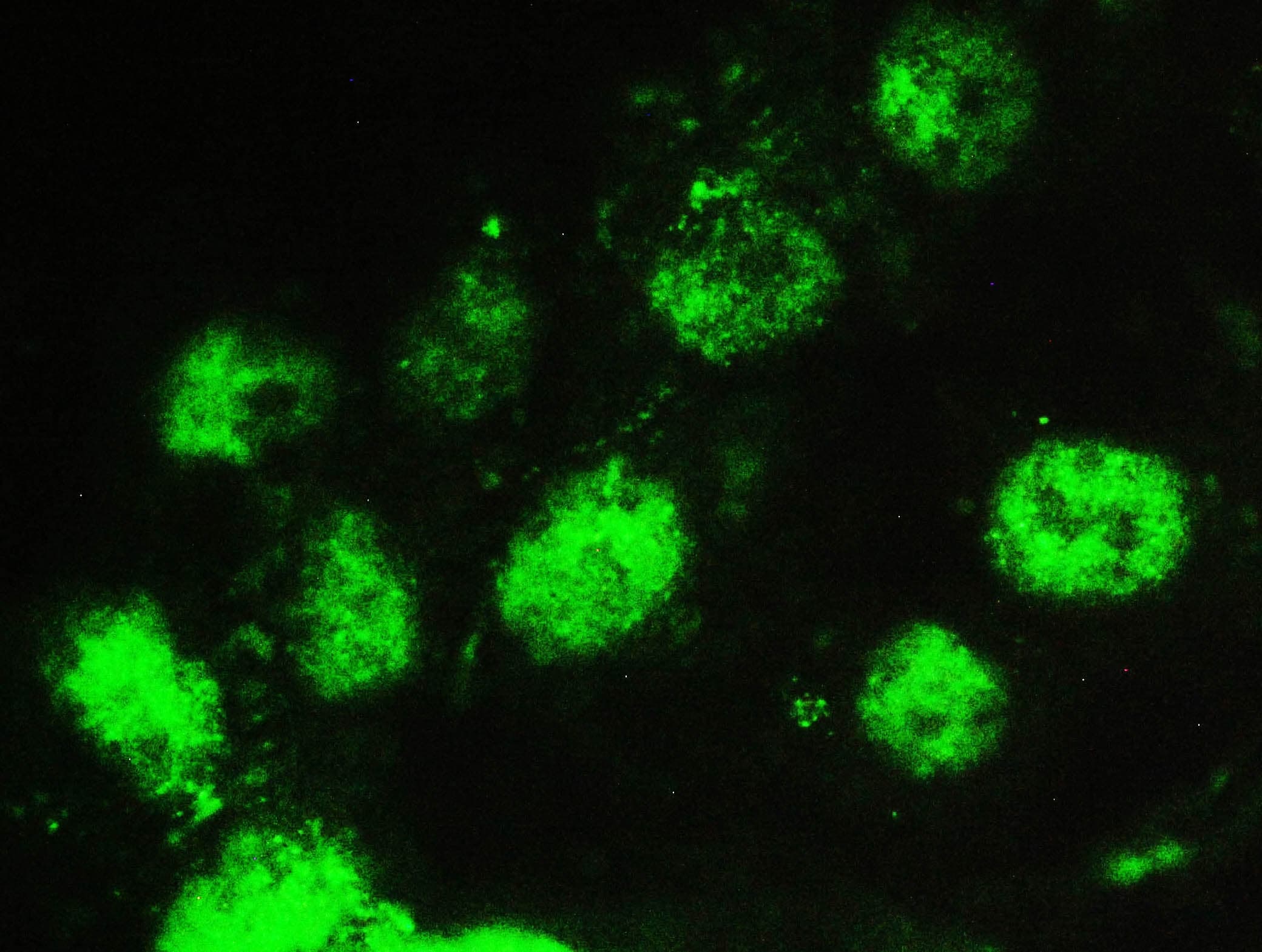 Polyclonal Rabbit anti-Human SP1 Antibody (IHC, WB)