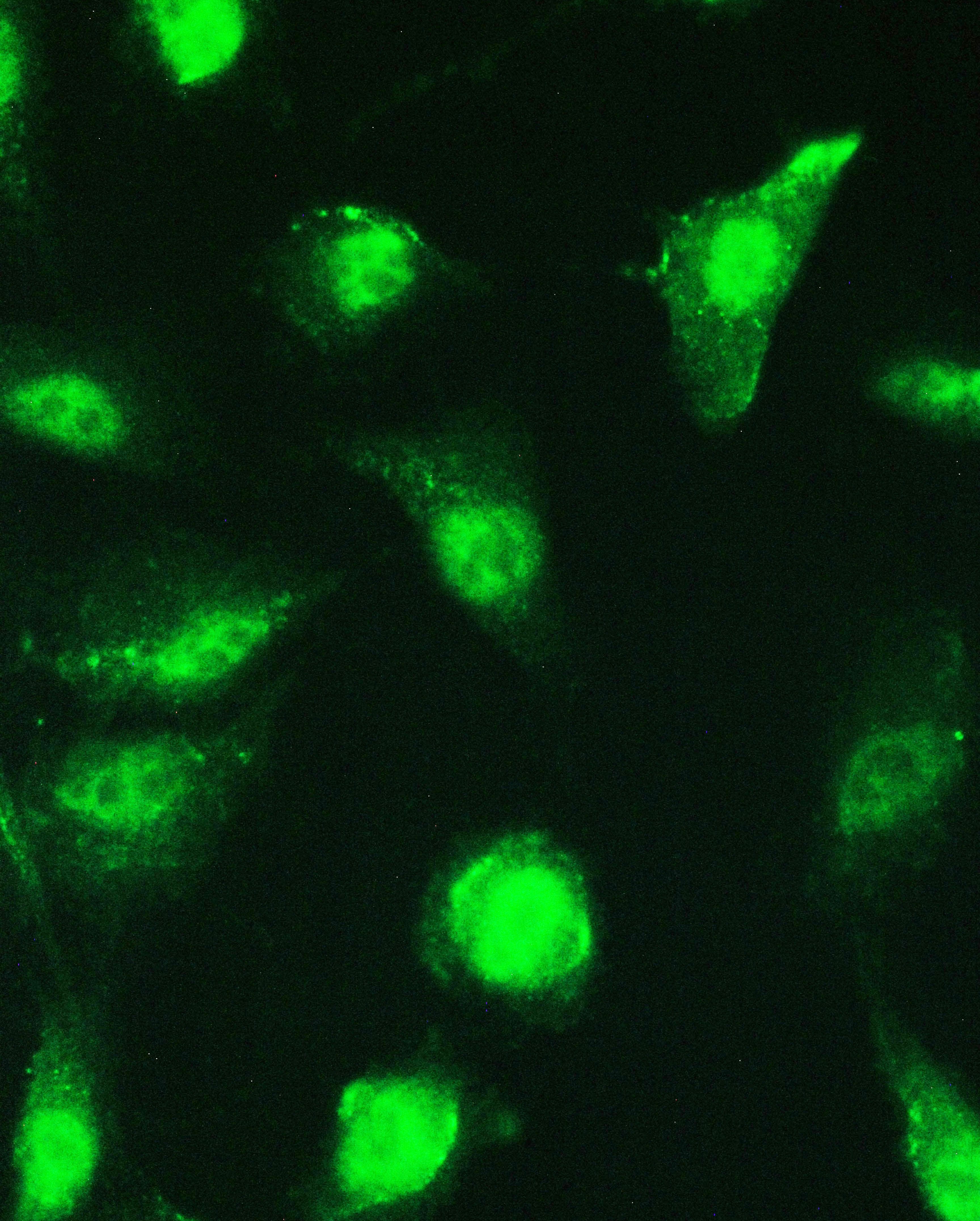 Polyclonal Rabbit anti-Human SP1 Antibody (IHC, WB)