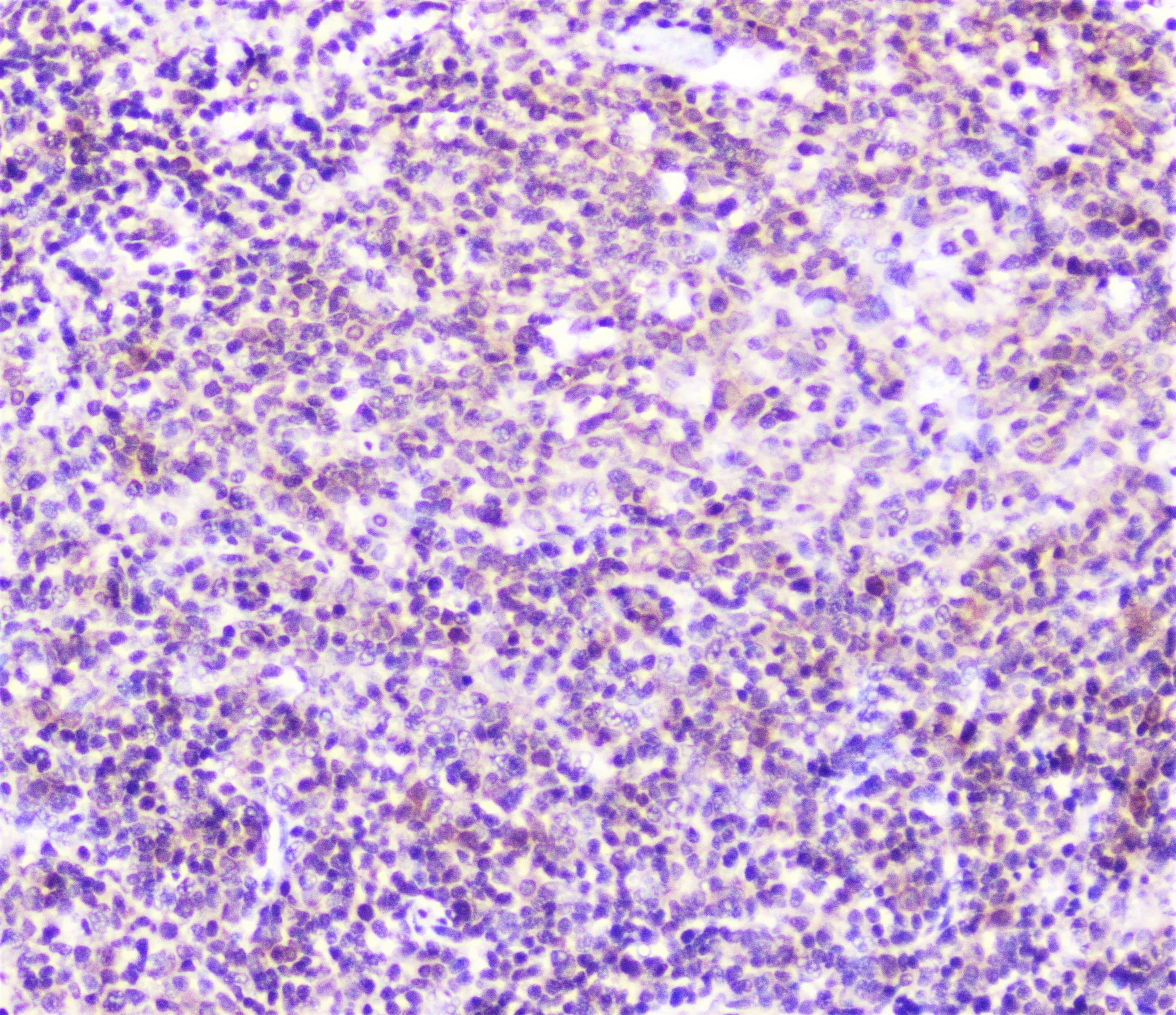 Polyclonal Rabbit anti-Human SP1 Antibody (IHC, WB)