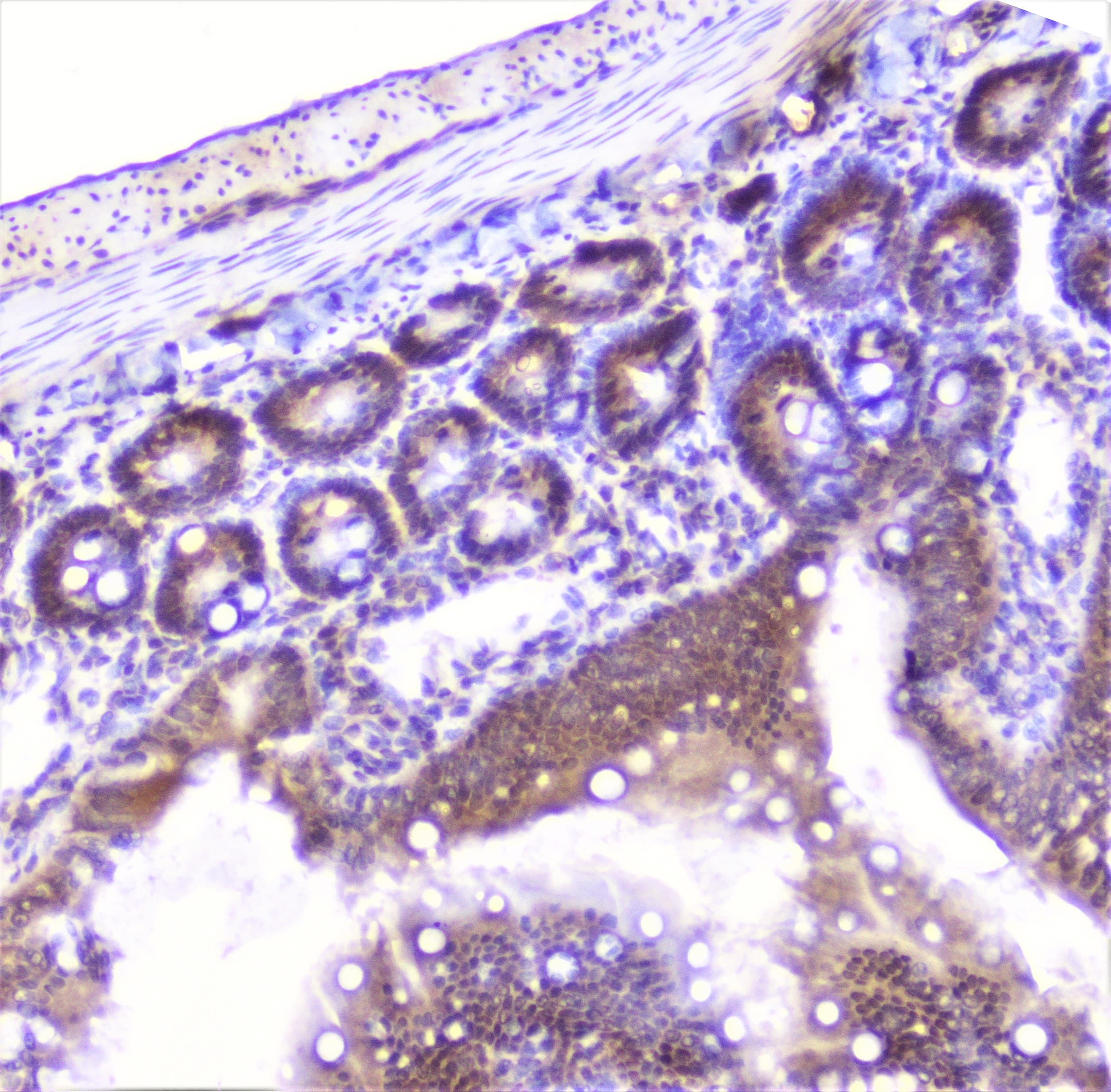 Polyclonal Rabbit anti-Human SP1 Antibody (IHC, WB)