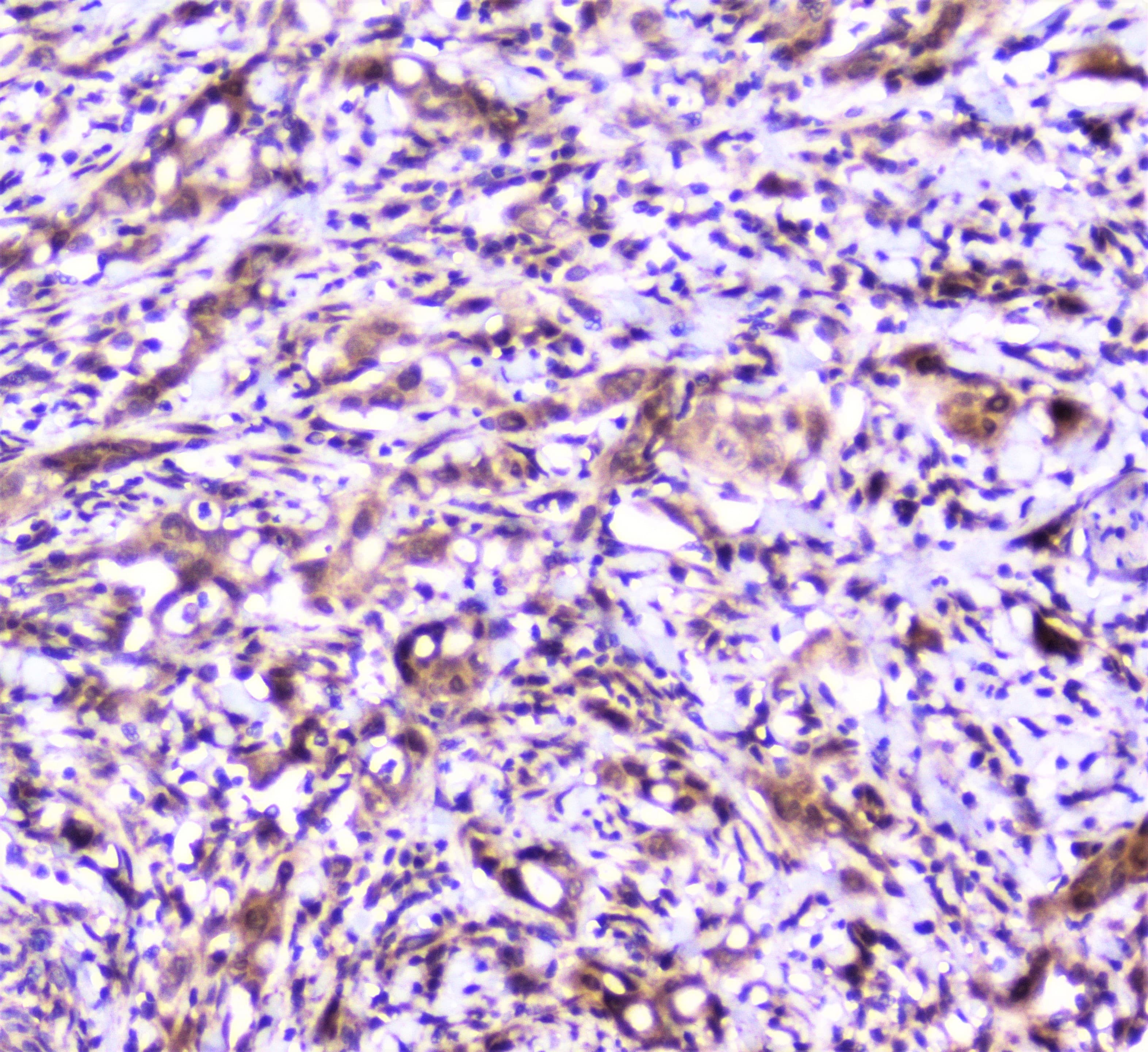 Polyclonal Rabbit anti-Human SP1 Antibody (IHC, WB)