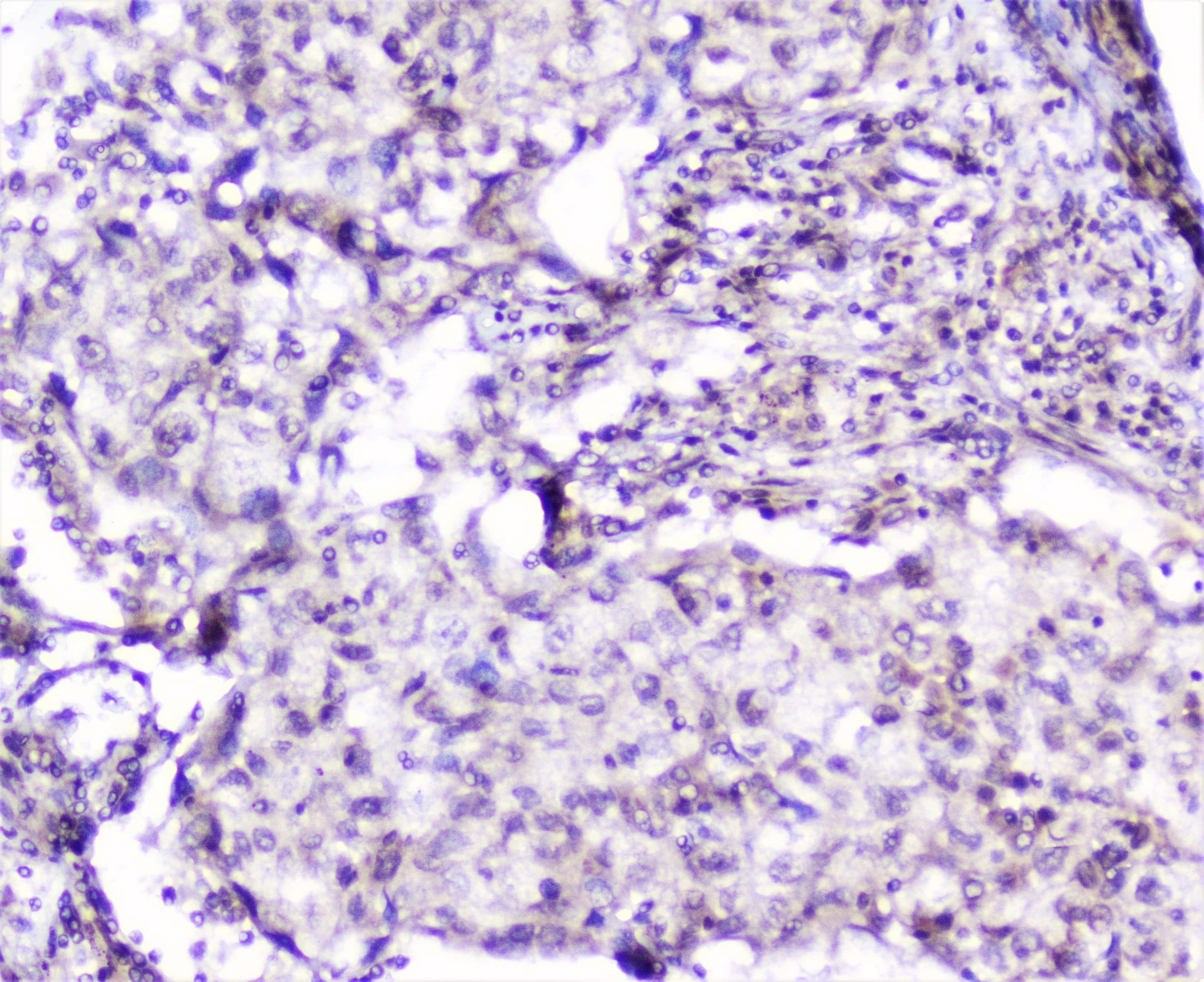 Polyclonal Rabbit anti-Human SP1 Antibody (IHC, WB)