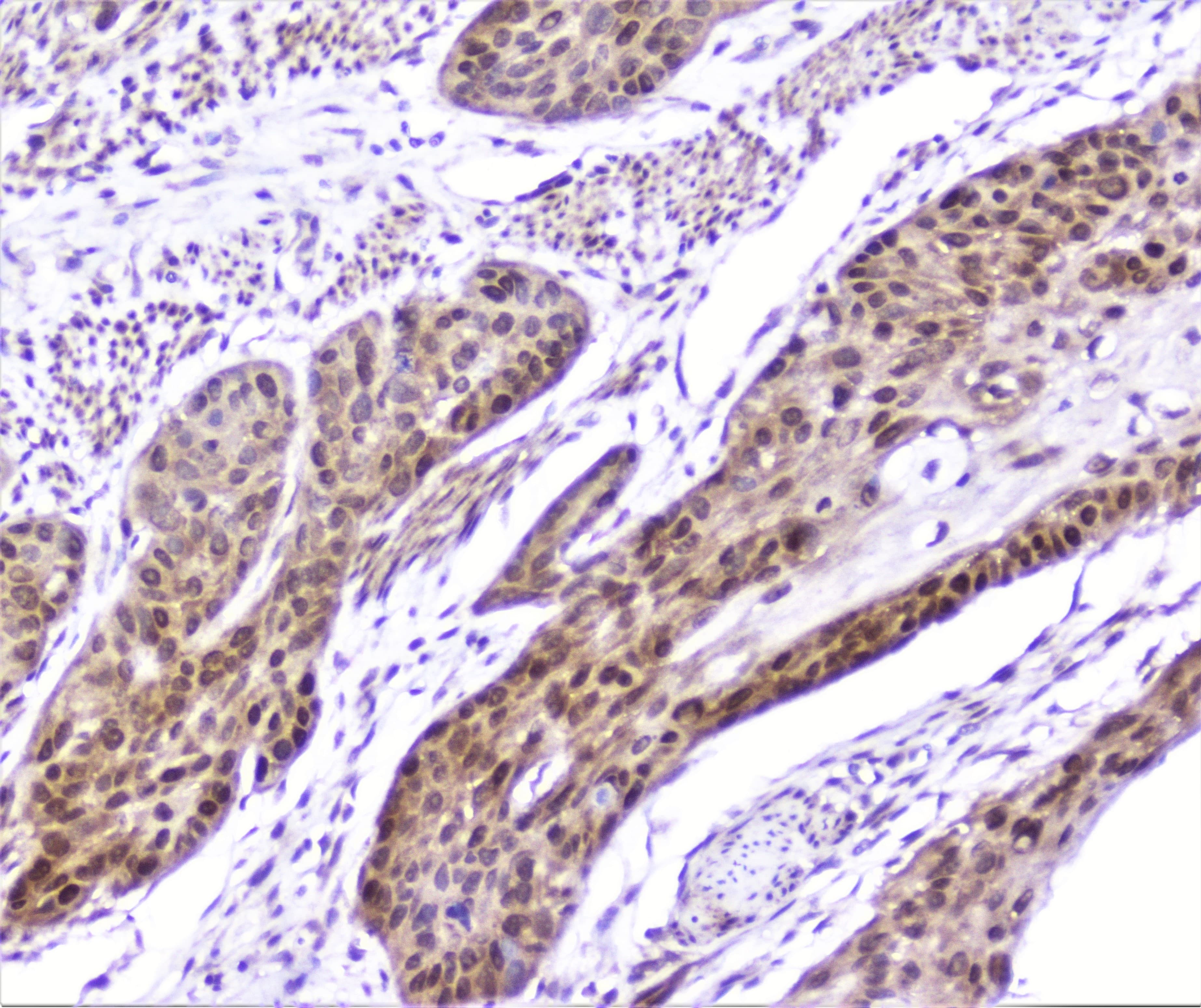 Polyclonal Rabbit anti-Human SP1 Antibody (IHC, WB)