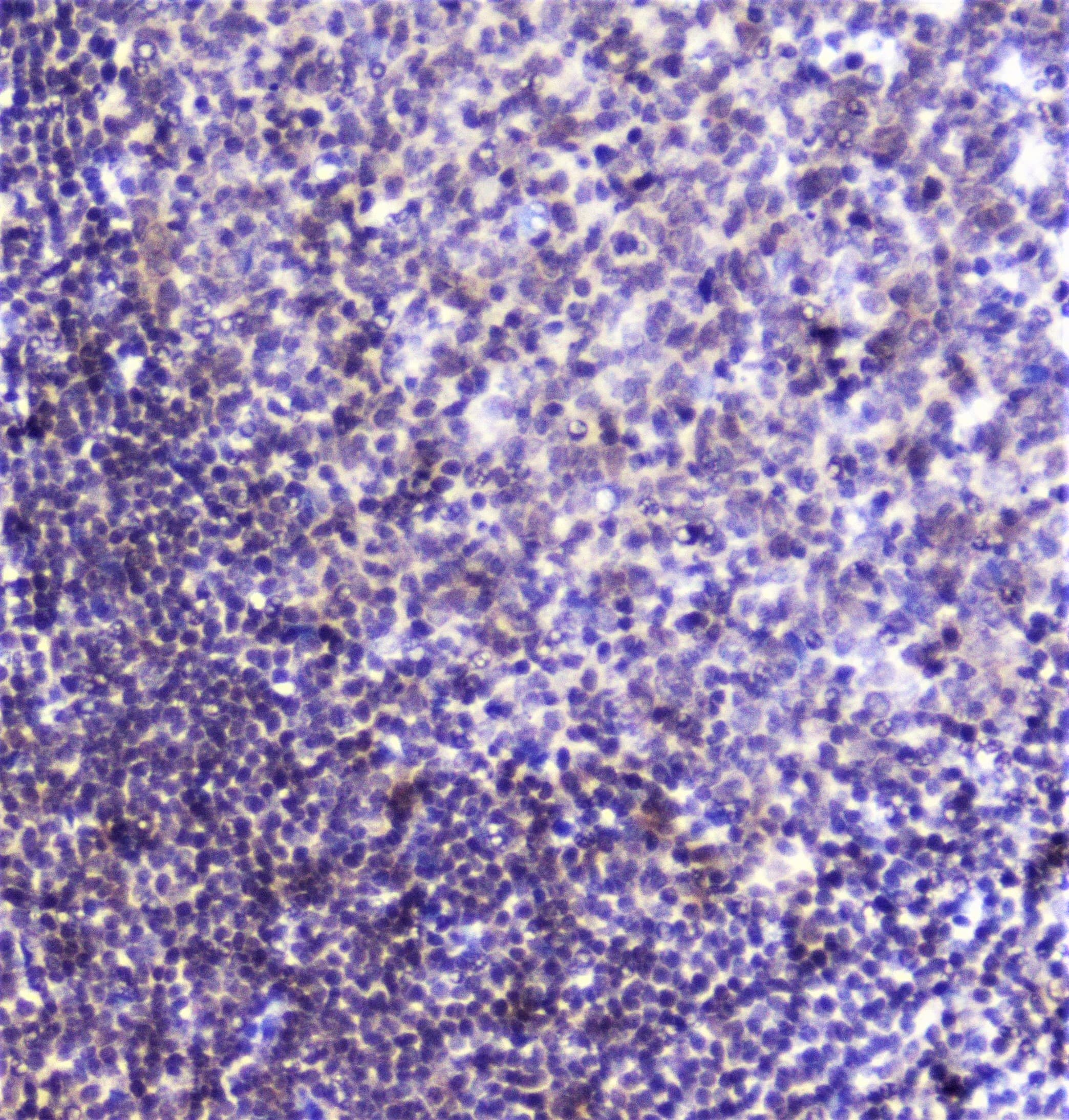 Polyclonal Rabbit anti-Human SP1 Antibody (IHC, WB)