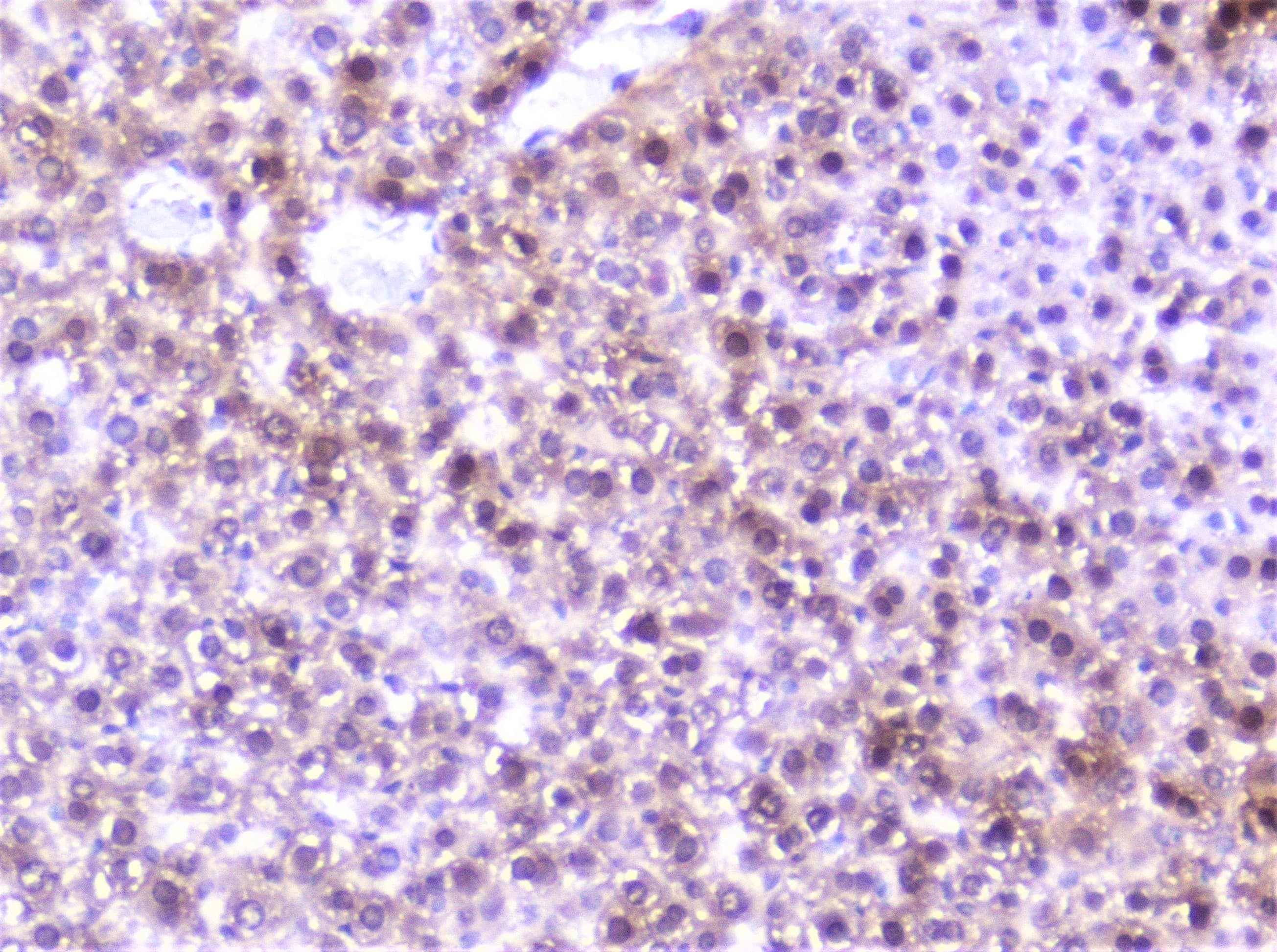 Polyclonal Rabbit anti-Human SP1 Antibody (IHC, WB)