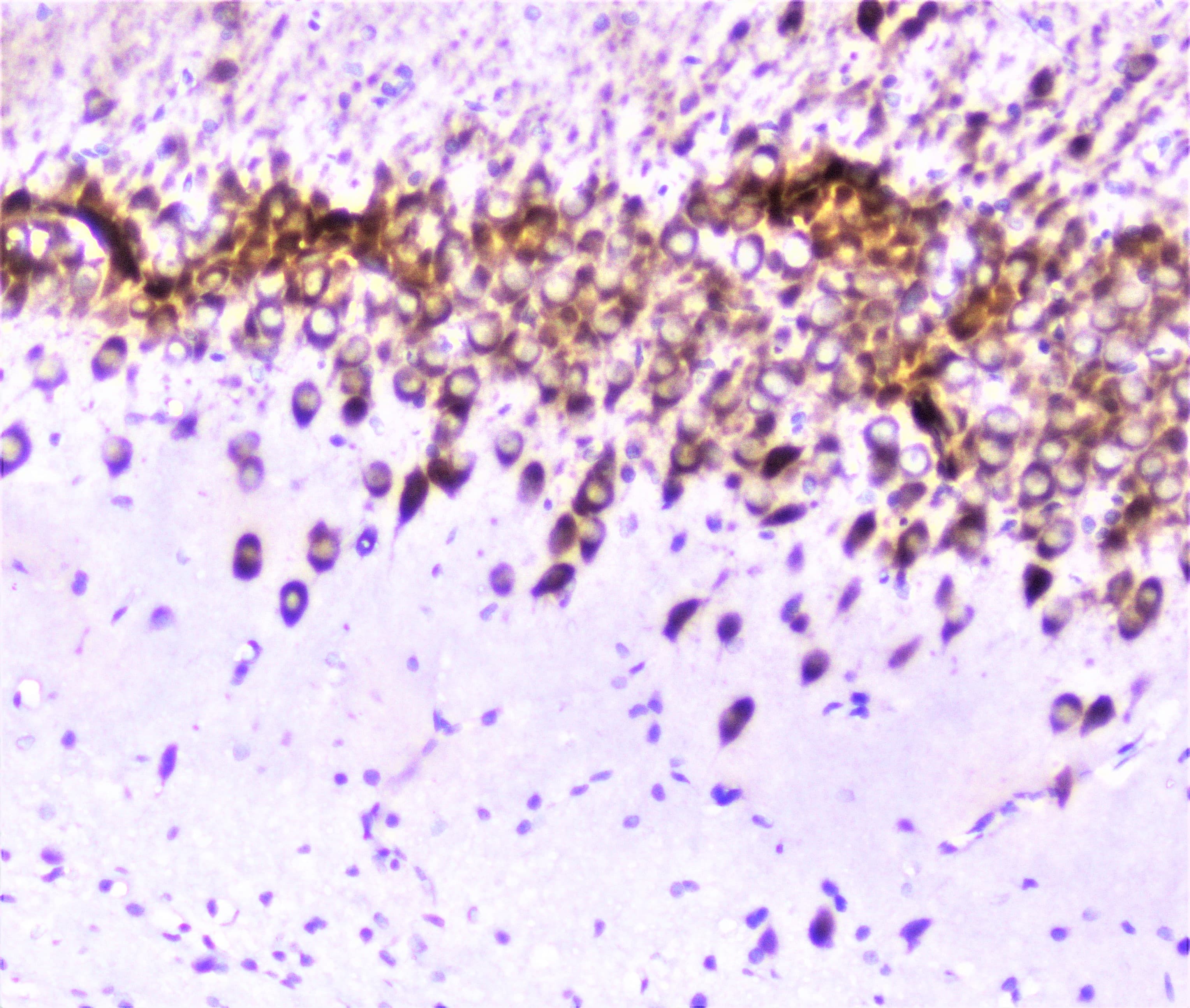 Polyclonal Rabbit anti-Human SP1 Antibody (IHC, WB)