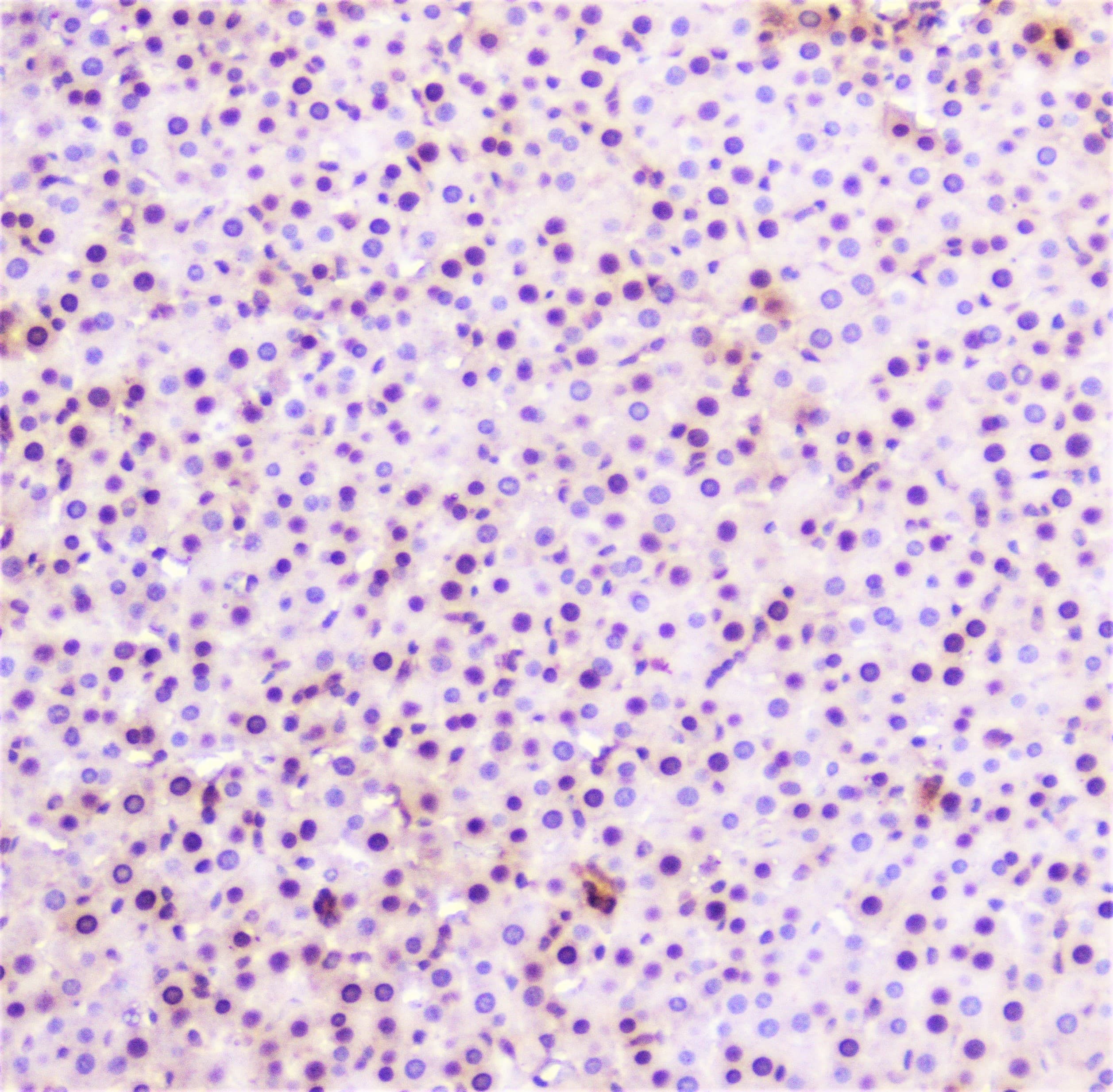 Polyclonal Rabbit anti-Human SP1 Antibody (IHC, WB)